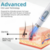 Laatste Dag 50% Korting!🔥I DermaZap™ – Laserpen tegen Wratten & Moedervlekken
