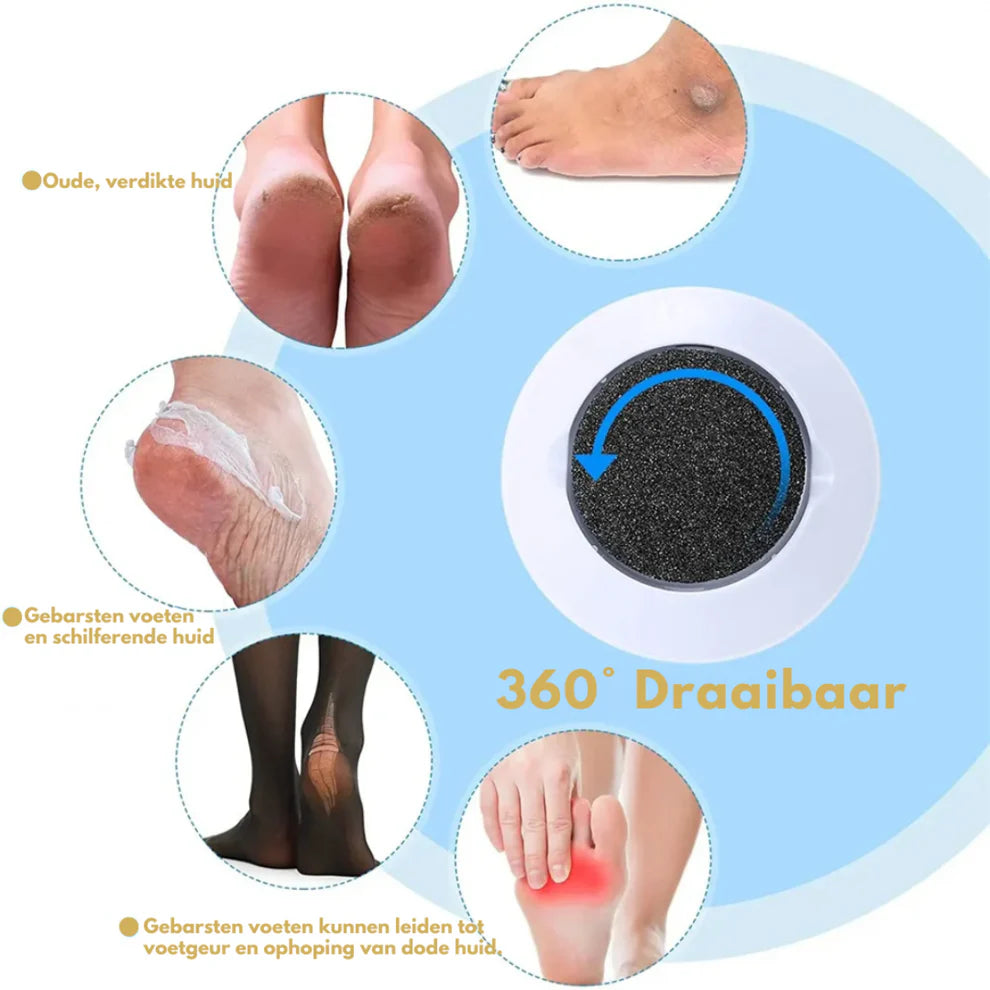 Laatste Dag 50% Korting!🔥I VelvaVac™ – Eeltverwijderaar met Vacuüm