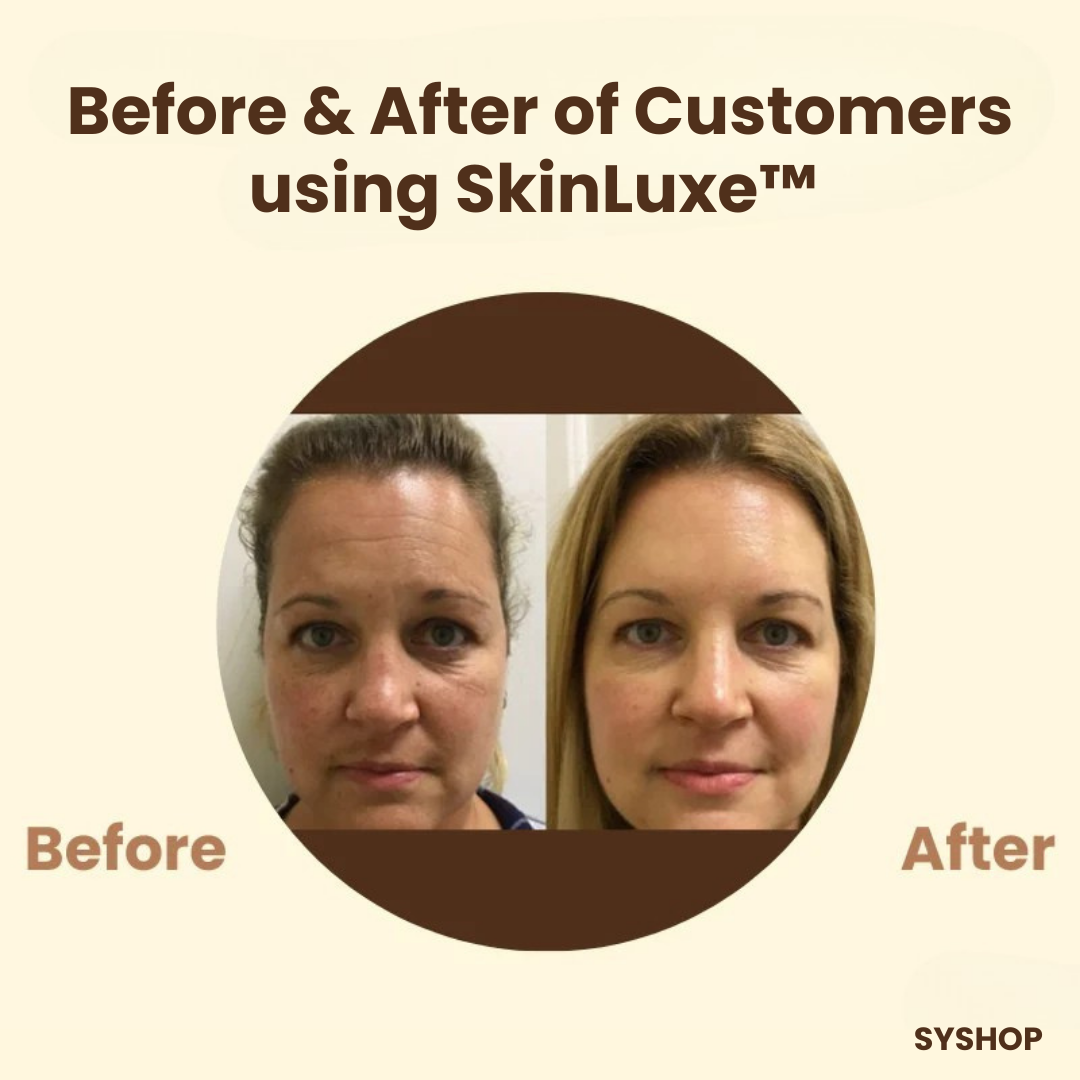 Laatste Dag 50% Korting!🔥I SkinLuxe™ - Zwarte Thee Gezichtsmasker