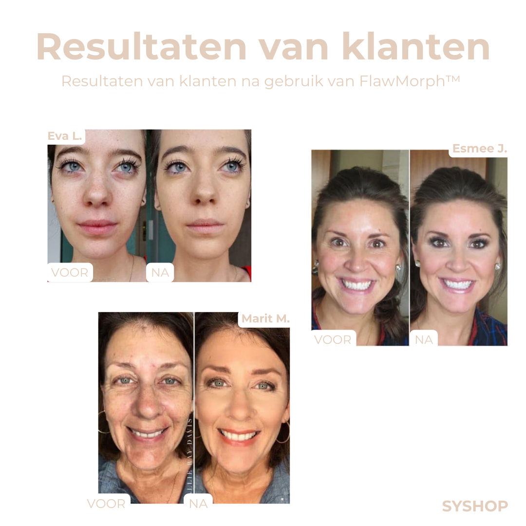 Laatste Dag 1+1 Gratis!🔥I FlawMorph™ - Kleuraanpassing voor Elke Huid