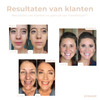 Laatste Dag 1+1 Gratis!🔥I FlawMorph™ - Kleuraanpassing voor Elke Huid