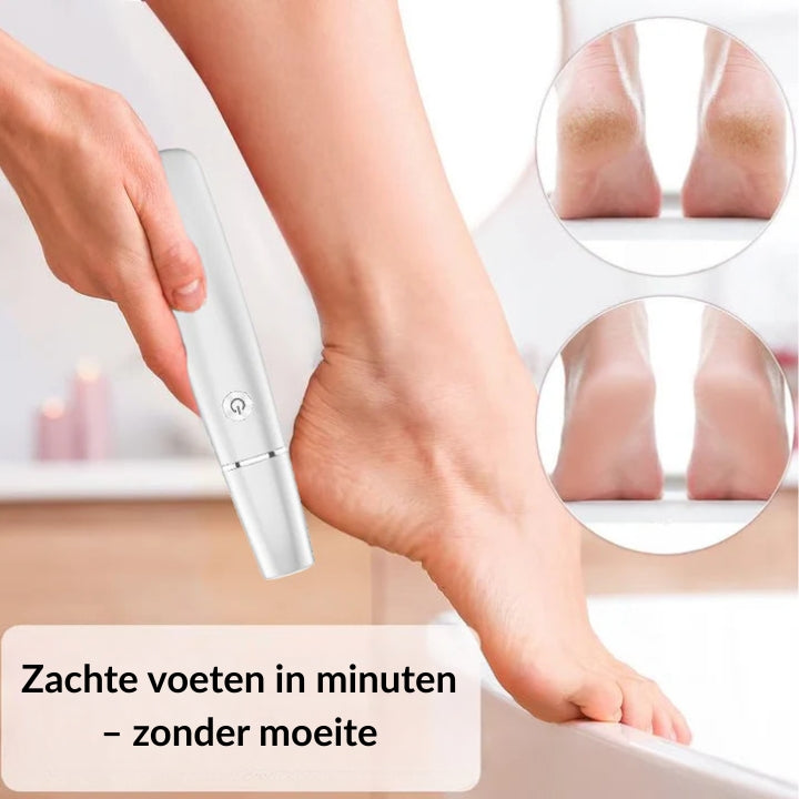 Laatste Dag 50% Korting!🔥I Smoothique™ – Elektrische Eeltverwijderaar