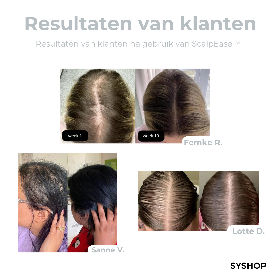 Laatste Dag 1+1 Gratis!🔥I ScalpEase™ Hoofdmassageborstel