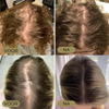 Laatste Dag 50% Korting!🔥I Folivive™ - Natuurlijke olie voor haargroei