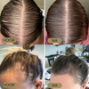 Laatste Dag 50% Korting!🔥I Folivive™ - Natuurlijke olie voor haargroei