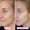 Laatste Dag 1+1 Gratis!🔥I FadeLixir™ – Vervaagt Vlekken & Herstelt Je Gloed