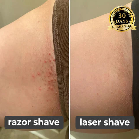 Laatste Dag 50% Korting!🔥I Glowrazor™ - Moeiteloos Gladde Huid