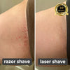 Laatste Dag 50% Korting!🔥I Glowrazor™ - Moeiteloos Gladde Huid