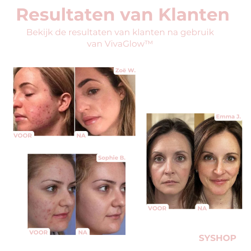 Laatste Dag 1+1 Gratis!🔥I VivaGlow™ - Stralende Huid in Één Stap met LED-Lichttherapie