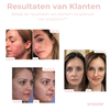 Laatste Dag 1+1 Gratis!🔥I VivaGlow™ - Stralende Huid in Één Stap met LED-Lichttherapie