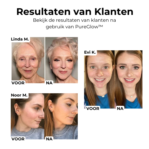 Laatste Dag 1+1 Gratis!🔥I PureGlow™ Schoonheidscrème