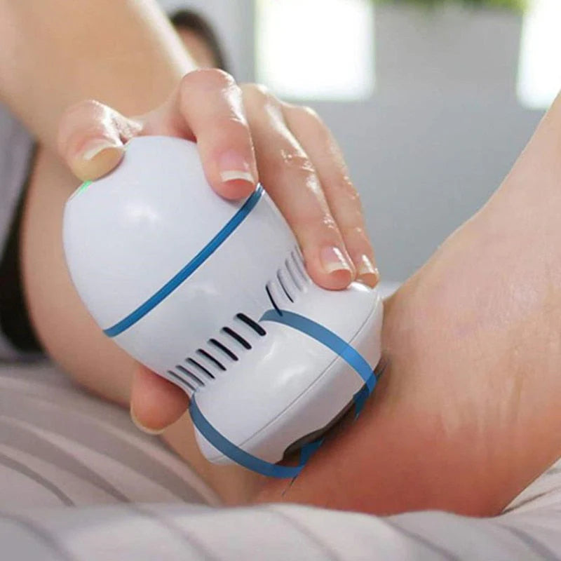 Laatste Dag 50% Korting!🔥I VelvaVac™ – Eeltverwijderaar met Vacuüm