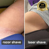 Laatste Dag 50% Korting!🔥I Glowrazor™ - Moeiteloos Gladde Huid